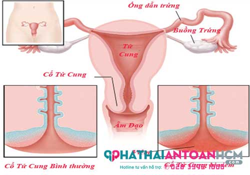 Bác sĩ phụ khoa ở tân bình