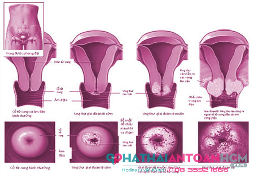 Địa chỉ phòng khám phụ khoa quận 4 tốt nhất hiện nay