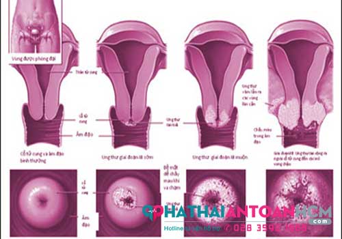 Phòng khám phụ khoa quận 4