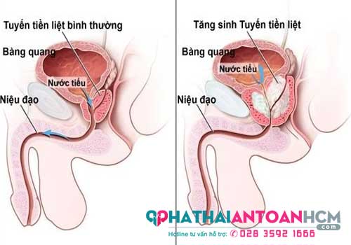 Phòng khám nam khoa ở quận 11 uy tín