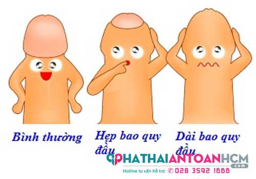 Dài hẹp bao quy đầu có quan hệ được không