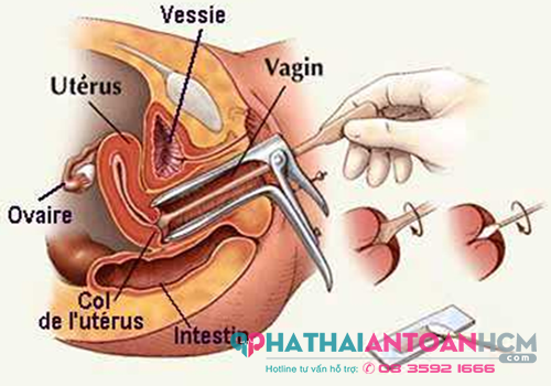 Phòng khám phụ khoa ở phú nhuận